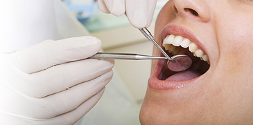 dental cleaning, oral health maintenance